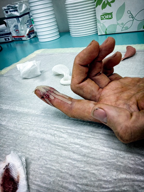 , Value your fingers? Wear gloves.